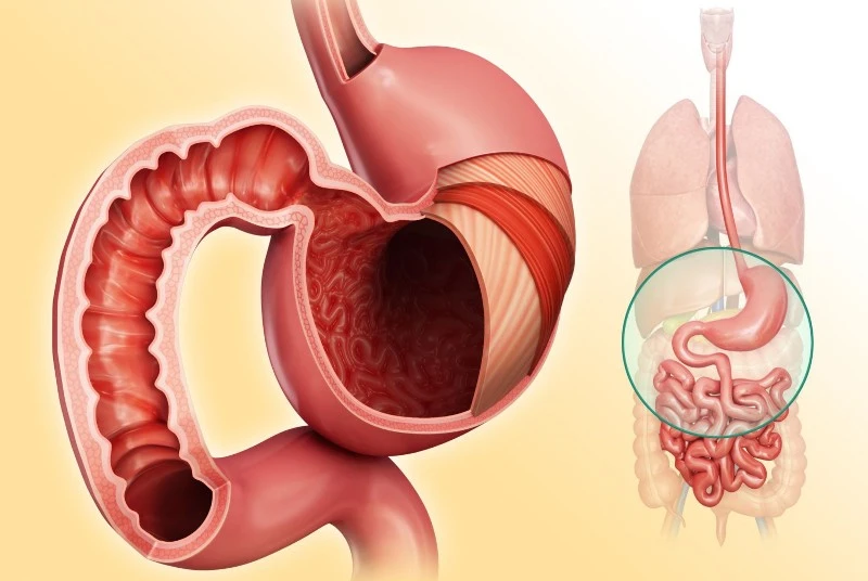 stomachintestines-57ffd6795f9b5805c2ac495f stomachintestines-57ffd6795f9b5805c2ac495f